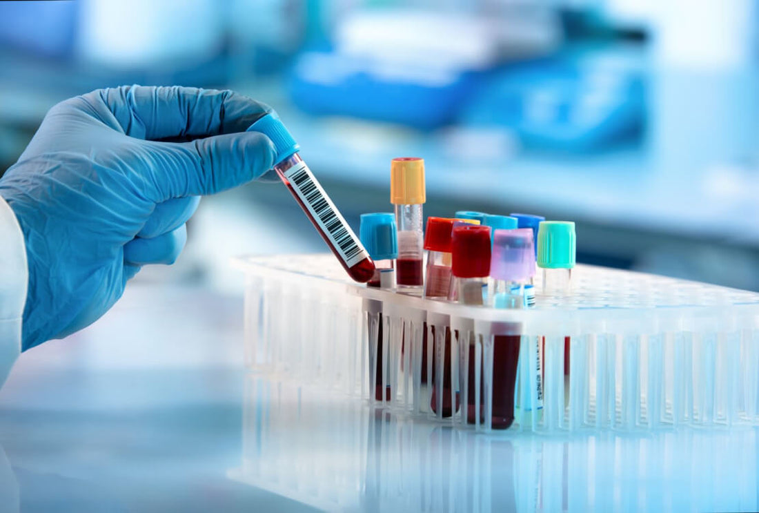 What Is NAD+? A Research Overview of Nicotinamide Adenine Dinucleotide